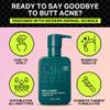 SKINBOSS Anti-Blemish Christmas Self-Care Gift Body Lotion for Buttne, Back Acne, Inner Thighs & Chest - Targets Folliculitis, Scars & Dark Spots  Holiday Hydrating Body Cream for Women & Men, 5 Oz view 2