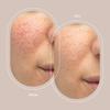 Trophy Skin Replacement Filters - Round Wool Air Filters - fits Trophy Skin Microdermabrasion Kit - 100 pack view 2