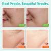 YEOUTH Skin Care Set for Visibly Smoother-Looking Skin 3-Piece view 3