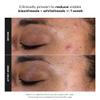 Paula's Choice SKIN PERFECTING 2% BHA Liquid Exfoliant, 4 Fl Oz view 4