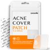 AVARELLE Acne Patches XL, Acne Cover Patch Large | Pimple Patches for Face Cheek & Nose (8 Count) | Large Hydrocolloid Acne Treatment with Tea Tree, Calendula, & Cica view 1
