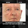Beverly Hills Mens Instant Facelift and Eye Serum Treatment for Dark Circles, Puffy Eyes, and Wrinkles view 3