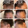 4oz Organic Cold Pressed Jamaican Black Castor Oil for Hair Growth and Damaged, Dry Scalp - Unscented, Hexane-Free view 4