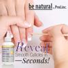 ProLinc Cuticle Eliminator, Softens and Removes Cuticles in Seconds, 4 oz view 2