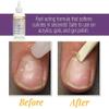 ProLinc Cuticle Eliminator, Softens and Removes Cuticles in Seconds, 4 oz view 3