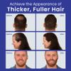 INFINITY Hair Fibers Grey for Thinning Hair for Women & Men - 100% Undetectable Hair Building Fiber Powder - Conceal Hair Loss in 15 Seconds, 15g view 2