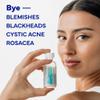 EMUAID Overnight Acne Treatment, Gentle Fast-Acting Solution with Salicylic Acid for Adults and Teens, Clears Stubborn Pimples, Cystic Acne, Blackheads, Rosacea, and Hormonal Breakouts, 1oz view 4