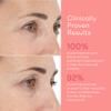 LightStim for Wrinkles LED Red Light Therapy with 72 LEDs (605, 630, 660, & 855 nm Wavelengths). Reduces Fine Lines, Wrinkles, Rejuvenates Skin, and Maintains a Youthful Appearance FDA Cleared White view 4