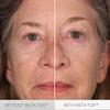 Serious Skincare INSTA-TOX Instant Wrinkle Smoothing Serum - Facial Filler Improves Appearance of Lines, Pores & Deep Wrinkles - Temporary Skin Tightener - Face Firming - .75 Fl Oz (2Pack) view 4