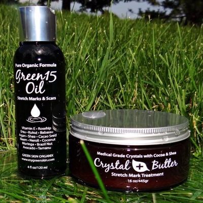 Best STRETCH MARK Complete Solution Kit- Medical grade microdermabrasion crystals mixed with Raw Cocoa Butter +organic 15 natural oils blend Stretch Mark COMPLETE KIT Microdermabrasion Crystal Butter & Green15 Oil shown to prevent and remove old stre