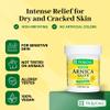 De La Cruz Arnica Salve - Foot Cream for Dry Cracked Heels and Feet - Moisturizing Hand Salve for Dried Hands - 24 Hour Moisture Foot Cream for Dry Cracked Feet and Rough Skin - (2 Ounces - 12 Jars) view 3