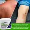 TriDerma Intense Fast Healing Cream, Decreases Healing Time for Minor Irritations, Rashes, Scrapes, Cuts 4 Ounces view 2