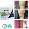 TriDerma Intense Fast Healing Cream, Decreases Healing Time for Minor Irritations, Rashes, Scrapes, Cuts 4 Ounces view 3