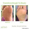 Get Fresh Rescue Me - Intensive Foot Cream for Dry Skin, Cracked Heels, and Calluses, with Shea Butter, Aloe, and Lemongrass, 170g view 3