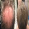 Caboki All-Natural Hair Building Fiber. Make Thin Hair Look 10X Fuller Instantly. Eliminate the Appearance of Bald Spot and Thinning Hair (30G, 90-Day Supply). Medium Brown view 4