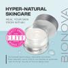 BIONOVA - Acne + Acne Scar Discovery Collection with UV Chromophores (3pk) view 2