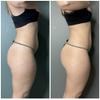 Guam Anti Cellulite Seaweed Wrap ORIGINAL FORMULA | Skin Tightening Cellulite Treatment For Thighs And Legs Inches Reduction - Hot Mud Thigh Wraps For Cellulite Removal, 1KG Beauty view 4