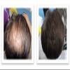 Caboki Hair Building Fiber 16G (Dark Brown) view 4