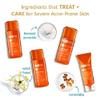 AcneFree Severe Acne Treatment System (2 Pack) view 3
