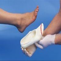 An innovative solution for taking a foot mold. Quick, clean application. Accelerated cure time within 2 minutes. Slips off easily. Excellent conformity to the plantar surface of the foot. Fast and easy without the mess of plaster of paris or the inac