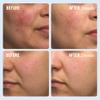 First Aid Beauty Ultra Repair Cream Intense Hydration Moisturizer for Face and Body  1 oz view 3