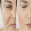 Precision Skin RX Vitality Tretinol Gel 0.50% view 3