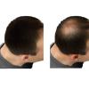 Empire Hair Max Keratin Loss Concealer Thickening Fibers Builder 0.88oz / 25gr (Gray) view 3