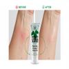 Outdoor Hands Poison Ivy Scrub  Pharmacist Developed Urushiol Remover for Poison Ivy, Oak & Sumac | Rash Relief Wash for Itching & Pain view 4