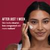 Peter Thomas Roth | Even Smoother Microdermabrasion Exfoliating Pore Purifier view 3