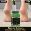 FOOT SPA Exfoliating Scrub Gel - Multi-Purpose Professional & Family Skincare Exfoliator | Pro-Grade Renewal, Zero Irritation for Visibly Radiant Skin & Lasting Smoothness 128 Oz view 4