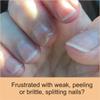 FlexiNail Fingernail Conditioner with FlexiNail Cuticle Conditioner for weak and peeling or brittle and cracking nails view 2