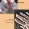 FlexiNail Fingernail Conditioner with FlexiNail Cuticle Conditioner for weak and peeling or brittle and cracking nails view 3