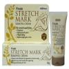 New Finale Stretch Mark Removal Cream 50g. Reduces stretch mark ridges and discoloration view 1