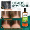 Medicasp Coal Tar Anti-Dandruff Shampoo, Alleviates Symptoms from 1st Wash, Treats Psoriasis, Seborrheic Dermatitis & Itchy Dry Scalp, Fights the Root Cause of Dandruff, Flakes Shampoo, 6 fl oz view 4