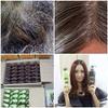 2Pcs Shampoo Scalp & HyBeauty Vitalizing Hair and Conditioner herbal natural. view 4