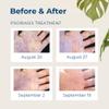 Gloves In A Bottle Shielding Lotion 2 oz Blister - Unparalleled relief for dry, cracked & irritated skin - For hands & body (Pack May Vary) view 4