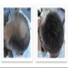 Caboki Hair Concealer (All-Natural Hair Building Fibers) Travel Size. Salt & Pepper - Light view 4