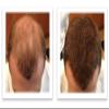 Caboki Hair Loss Concealer (All-Natural Hair Building Fibers) Travel Size (Auburn) view 4