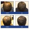 Foligain Triple Action Shampoo For Thinning Hair, Mens Volumizing Shampoo, with 2% Trioxidil 8 Fl. Oz. view 4