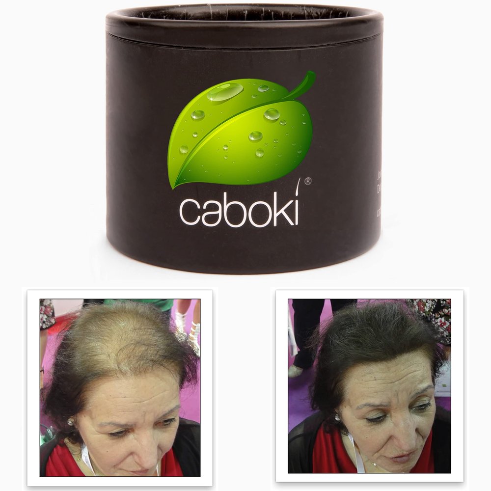Caboki Hair Fibers for Thinning Hair Natural Plant-Based Bald Spot Cover Up for Men and Women Instantly Thicker Fuller Looking Scalp Clean Ingredients Trial Size, 10-Day Supply, Dark Brown