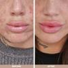 Australian Bodycare Spot Stick 0.3OZ view 4