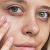 Vow Beauty Happily Ever After 10% Niacinamide Eye Gel for Dark Circles, .5 oz view 3