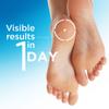 Flexitol Heel Balm, Rich Moisturizing & Exfoliating Foot Cream, 4 Oz Tube (Pack of 2) view 3