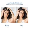 Blue Nectar Anti Dandruff Hair Oil with Neem & Tea Tree| Ayurvedic Non-Stickyfor Dry Scalp | Plant Based for Men & Women (12 Herbs, 6.76FlOz) view 4