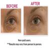 DNA CODE Skin Care 100% Solution Anti-Eye bag, Anti-Dark Circle, Anti-Puffy Eyes By Eyeseryl Tetrapeptide Add To Your Eye Gel or Cream view 4