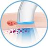 Tria Beauty Positively Clear Acne Device, 1 Count view 3