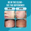 Teenology Teen Shampoo  Avoid Acne Breakouts, Non-Comedogenic, For Dry & Oily Scalps, Sulfate & Paraben Free, Natural Botanical Extracts, for Clear Skin & Healthy Hair, 16 oz  (Mint) view 4