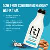 Teenology Teen Conditioner  Avoid Acne Breakouts, Non-Comedogenic, For Dry & Oily Scalps, Sulfate & Paraben Free, Natural Botanical Extracts, for Clear Skin & Healthy Hair, 16 oz  (Vanilla Almond) view 2