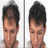 MAXX PRO-SERIES Volumizing Hair Fibers with real Keratin for Thinning Hair/Hair Loss  Dermatologist Tested and Certified Hypoallergenic - 60 days + supply - Multiple Colors Available (Light Brown) view 2