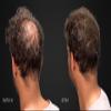 MAXX PRO-SERIES Volumizing Hair Fibers with real Keratin for Thinning Hair/Hair Loss  Dermatologist Tested and Certified Hypoallergenic - 60 days + supply - Multiple Colors Available (Light Brown) view 4